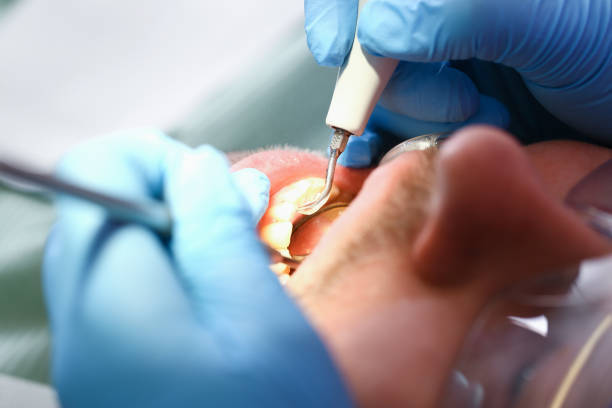 Best Emergency Treatment for Toothache in Stevensville, MD
