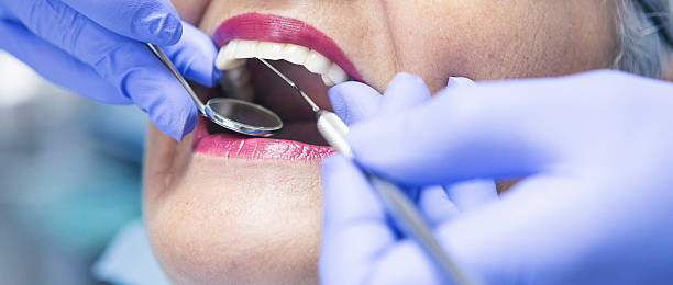 Best Emergency Broken Tooth Repair in Stevensville, MD